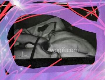 七夕GAY送爆菊花？頭塞屁股肛裂進(jìn)了急診（重口圖）